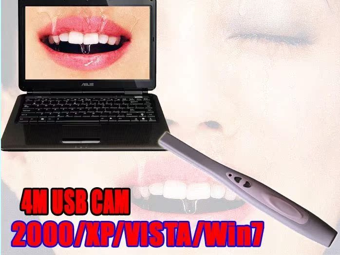ME-740 USB口腔内窥镜 高性价比CMOS镜头USB单输出口腔内窥镜